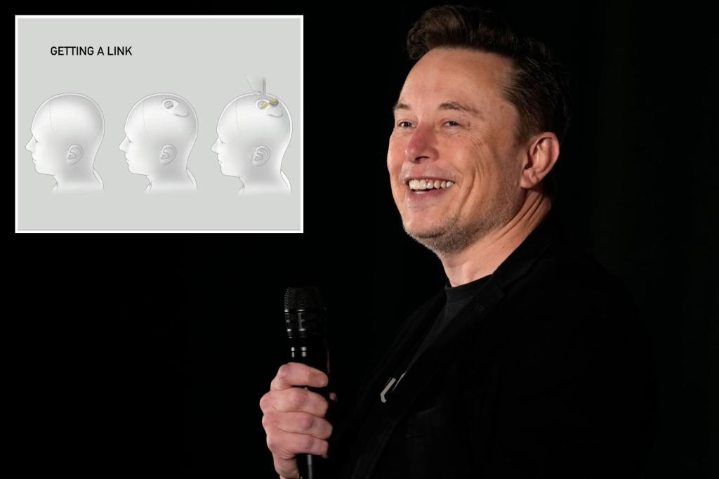 Elon Musk reveals third person received Neuralink brain chip implant as rival companies challenge